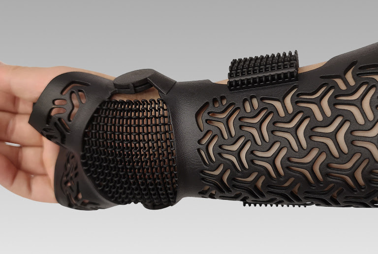 Arm with a 3D printed black cast